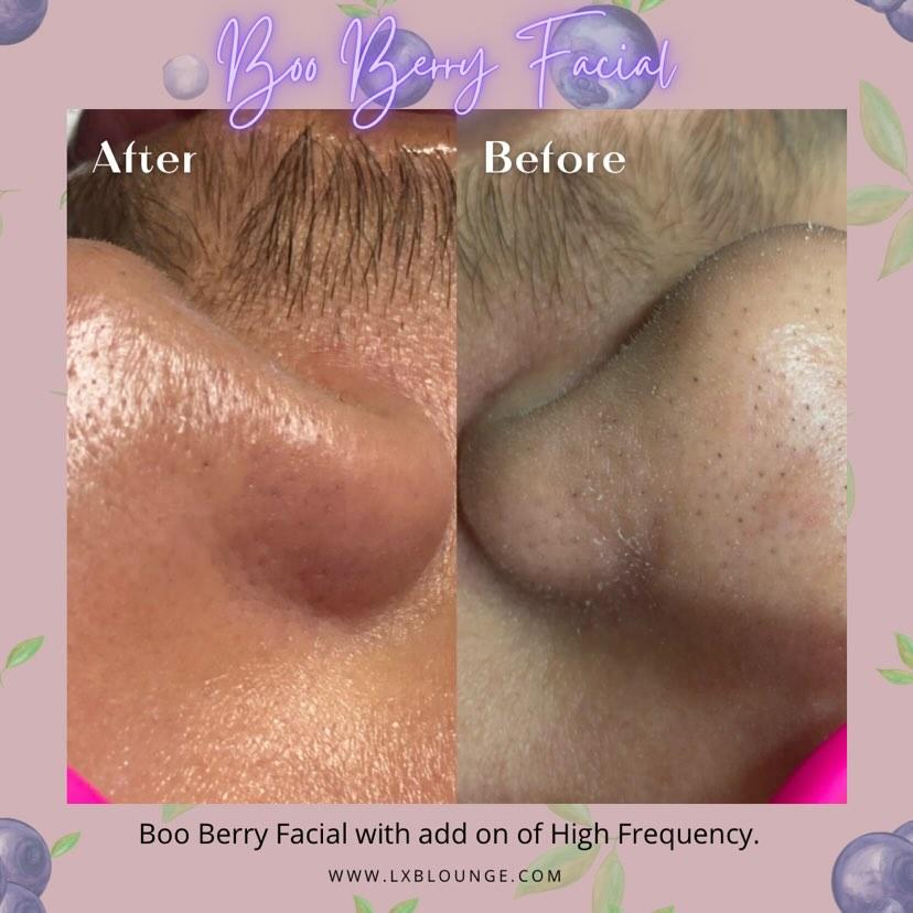 ZAQ Nova Powerful Ultrasonic Scrub Spatula by ZAQ Skin & Body