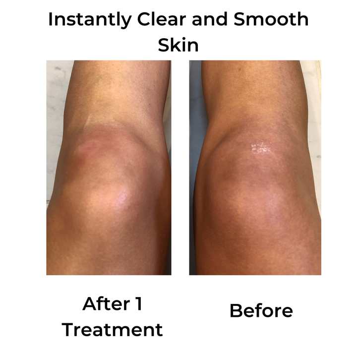 Lucky Skin Hydro by Lucky Skin