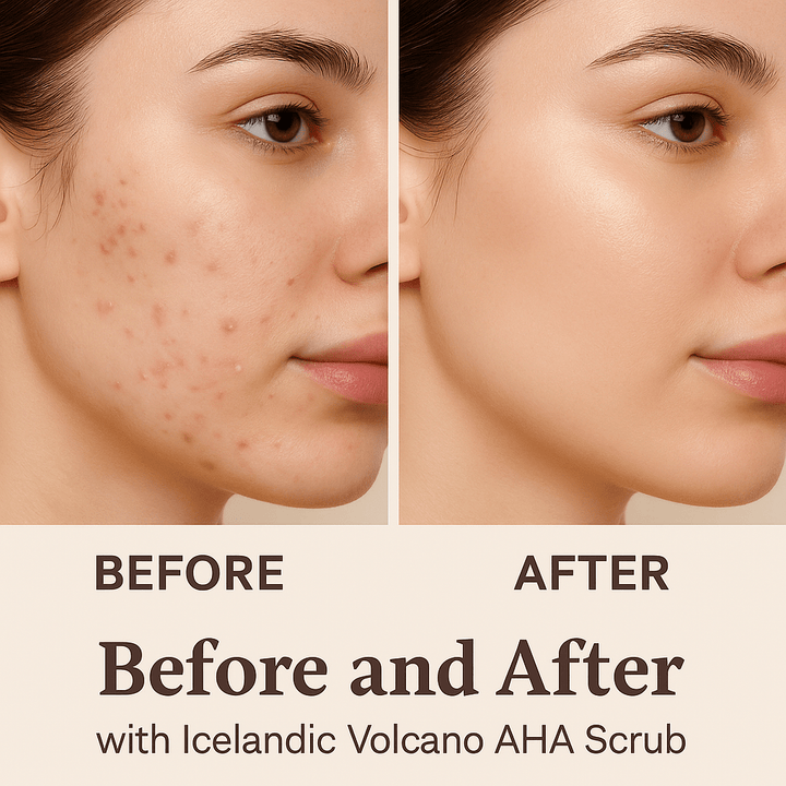 Icelandic Volcano AHA Face & Body Scrub